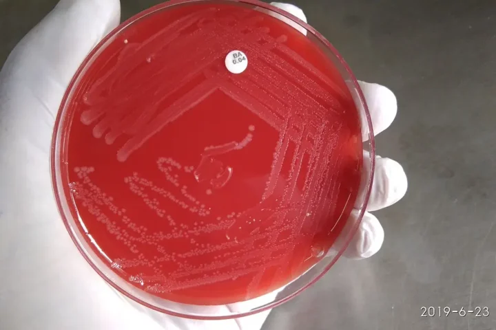 Gloved hand holding a red blood-agar petri dish showing streaked Listeria monocytogenes colonies.