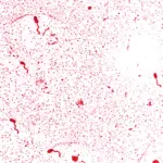 Microscopic image of Vibrio cholerae bacteria with flagella stain showing curved rod-shaped microbes associated with waterborne infections
