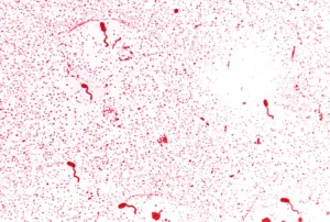 Microscopic image of Vibrio cholerae bacteria with flagella stain showing curved rod-shaped microbes associated with waterborne infections