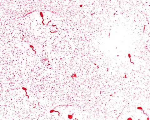 Microscopic image of Vibrio cholerae bacteria with flagella stain showing curved rod-shaped microbes associated with waterborne infections