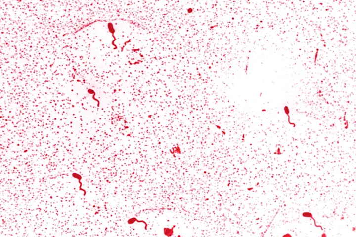 Microscopic image of Vibrio cholerae bacteria with flagella stain showing curved rod-shaped microbes associated with waterborne infections