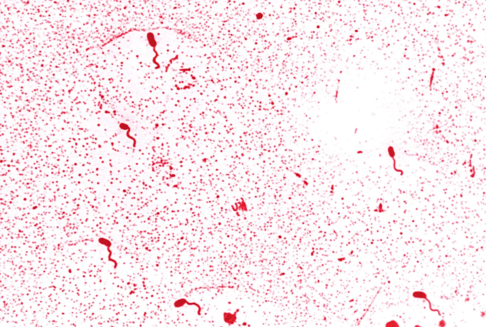 Microscopic image of Vibrio bacteria — curved rod-shaped microbes associated with waterborne infections