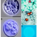 Cyclospora Outbreak: 1,947 Sick Across 9 States, Taco Bell Lettuce Recalled