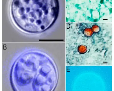 Five-panel microscopy image of Cyclospora cayetanensis oocysts at different magnifications (panels A–E), showing unfluoresced and fluorescence-stained views of the single-celled parasite with scale bars for size reference.