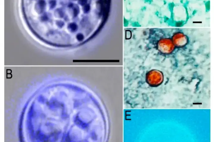 Five-panel microscopy image of Cyclospora cayetanensis oocysts at different magnifications (panels A–E), showing unfluoresced and fluorescence-stained views of the single-celled parasite with scale bars for size reference.