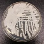 Candida Auris Spreads to 23 US States: 3,000+ Drug-Resistant Fungal Cases Reported in 2026