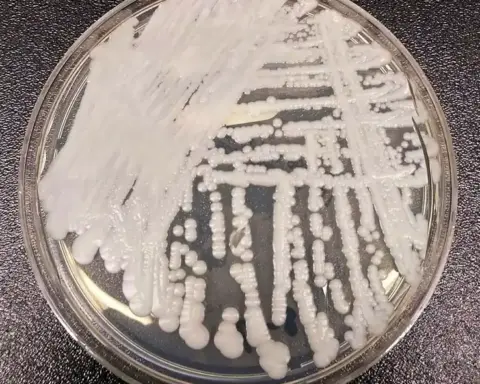 White yeast colonies of Candida auris cultured on an agar streak plate in a laboratory.