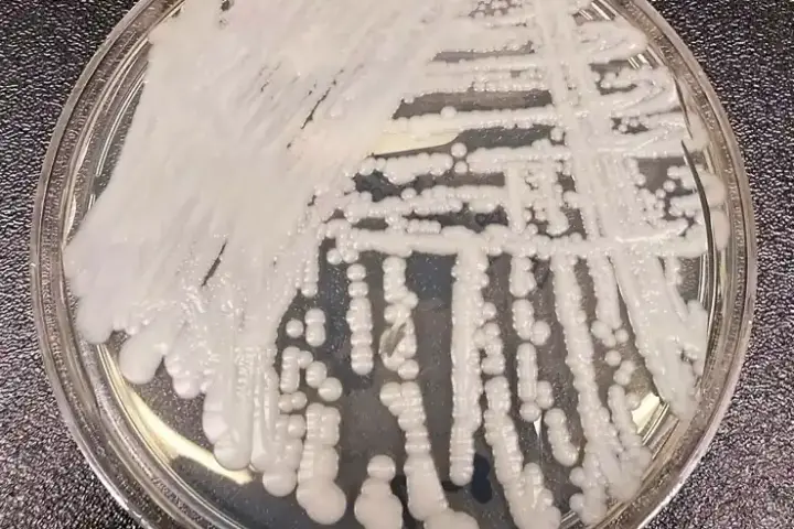 White yeast colonies of Candida auris cultured on an agar streak plate in a laboratory.