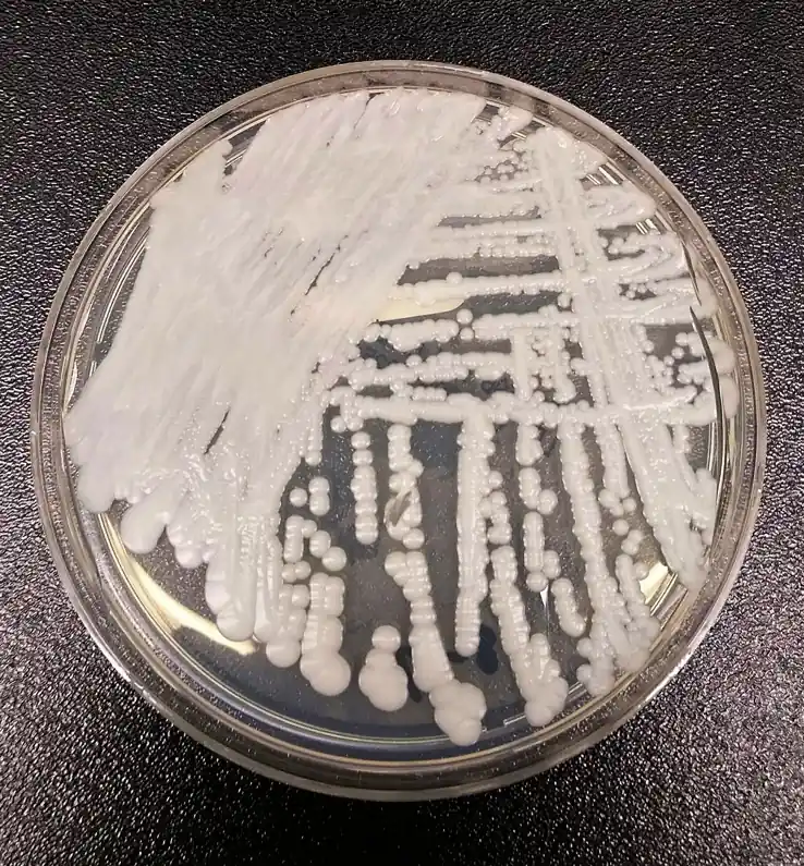 White yeast colonies of Candida auris cultured on an agar streak plate in a laboratory.