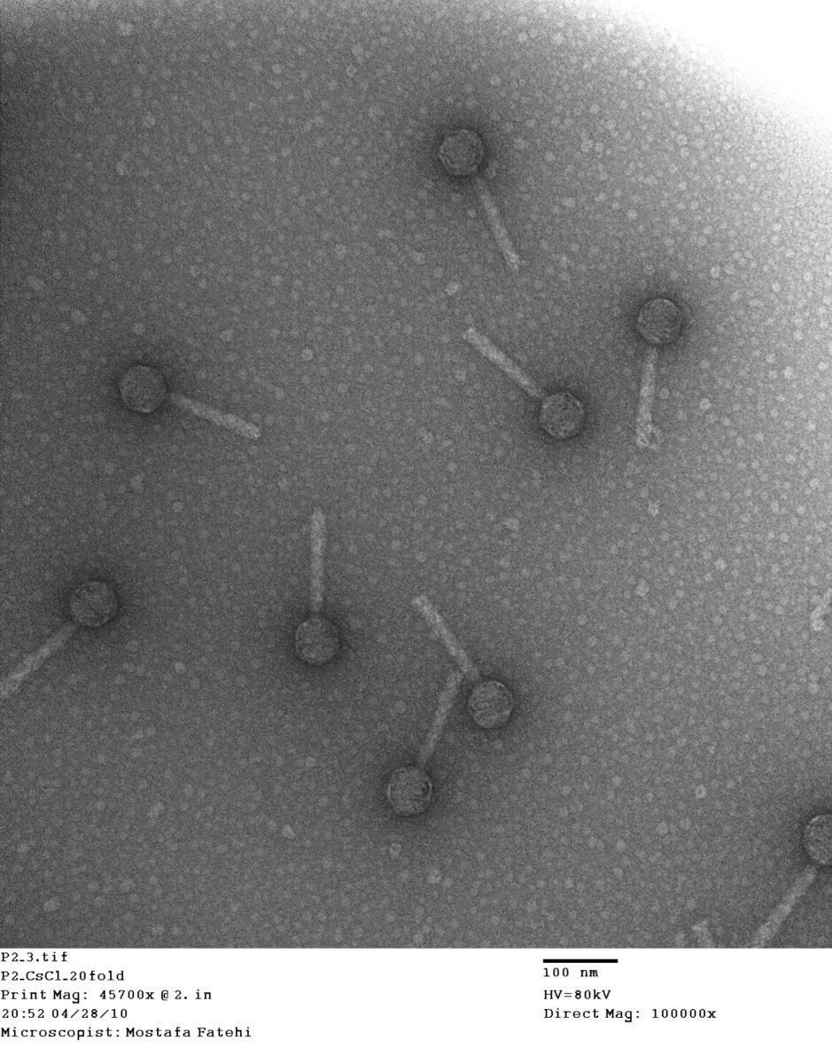 Stanford AI Creates Never-Before-Seen Viruses: 16 Bacteriophages Beat Antibiotic Resistance