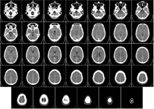 Human brain