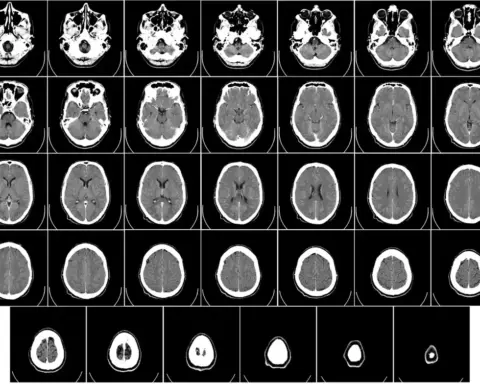 Human brain