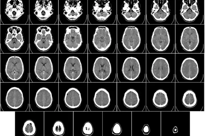 Human brain