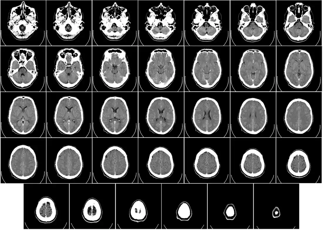 Lab-Grown Brain Tissue Matches Human Development Over Six Years