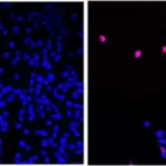 FDA Approves Pancreatic Cancer Drug Showing 13.2 Month Median Survival