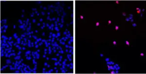 Molecular visualization of a RAS inhibitor drug binding to pancreatic cancer cells for targeted therapy