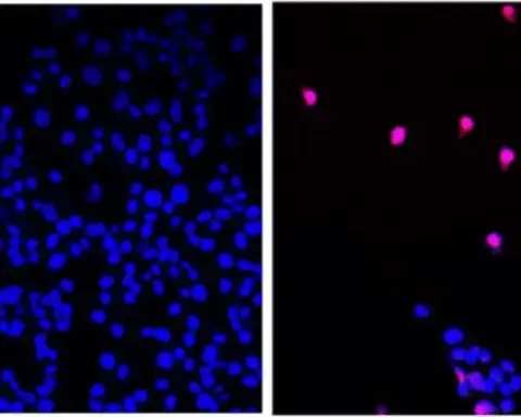Molecular visualization of a RAS inhibitor drug binding to pancreatic cancer cells for targeted therapy