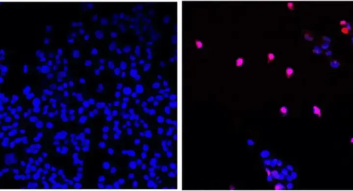 Molecular visualization of a RAS inhibitor drug binding to pancreatic cancer cells for targeted therapy