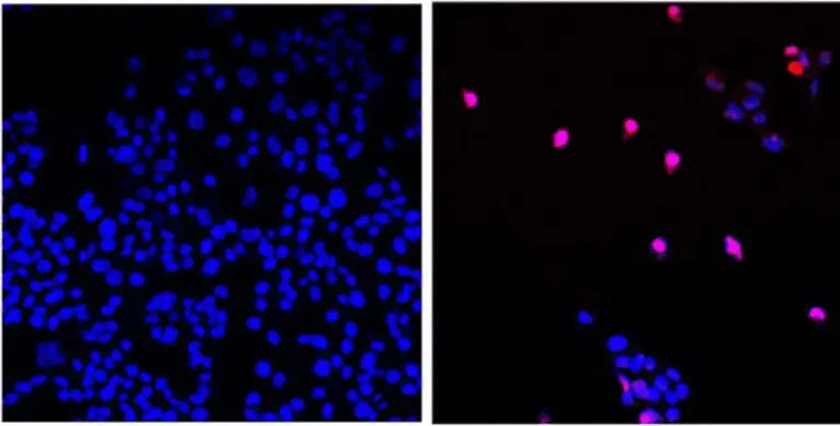 Molecular visualization of a RAS inhibitor drug binding to pancreatic cancer cells for targeted therapy