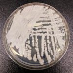 Deadly Fungus Spreading Across 27 States: CDC Alert