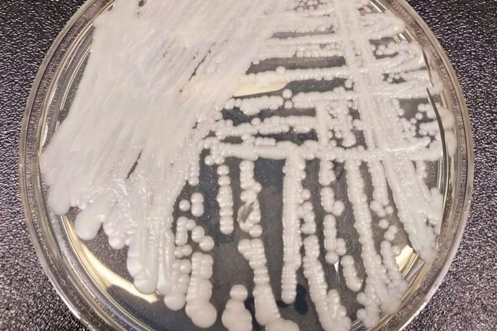 Candida auris cultured in a petri dish at a CDC laboratory