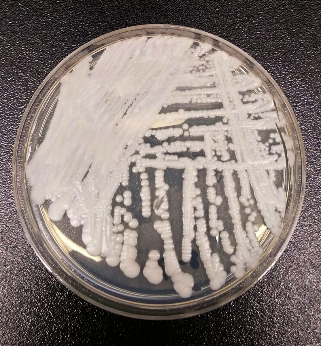 Candida auris cultured in a petri dish at a CDC laboratory