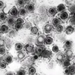 COVID-19 Awakens Dormant Viruses, and One Family Is Tied to Long COVID