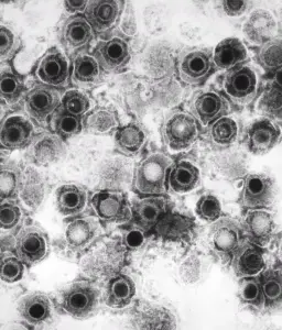 Herpesvirus particles seen by transmission electron microscopy, representing the dormant viruses COVID-19 can reactivate.