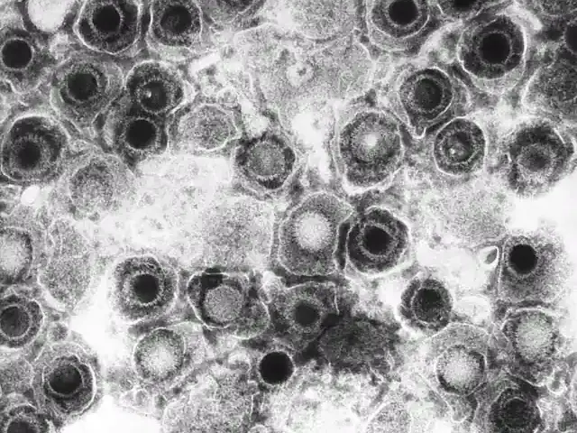 Herpesvirus particles seen by transmission electron microscopy, representing the dormant viruses COVID-19 can reactivate.