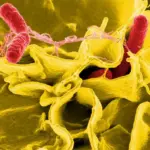 Egg Recall Alert: FDA Escalates Salmonella Contamination To Class I Level