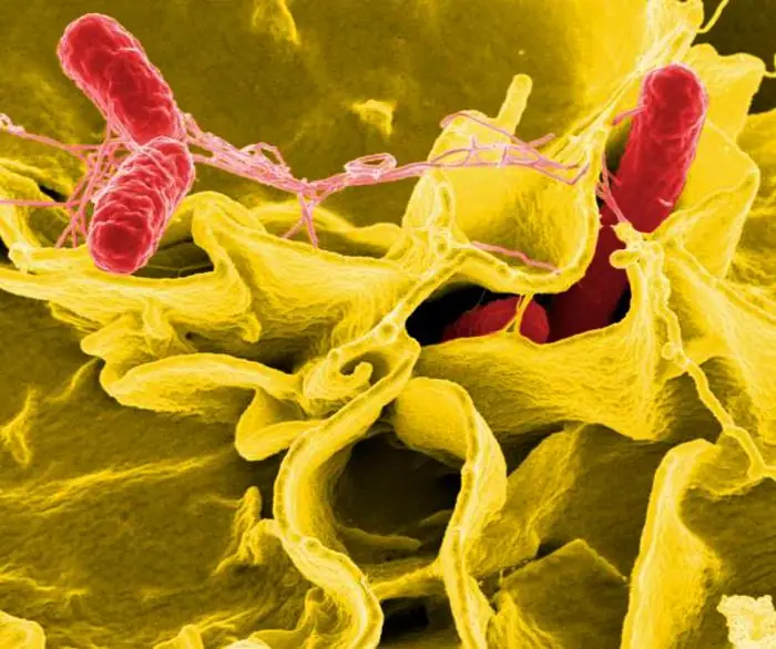 Egg Recall Alert: FDA Escalates Salmonella Contamination To Class I Level