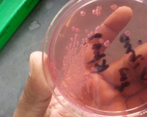 Bacteria cultured on an agar plate, representing Vibrio vulnificus