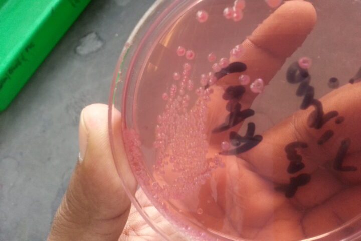 Bacteria cultured on an agar plate, representing Vibrio vulnificus