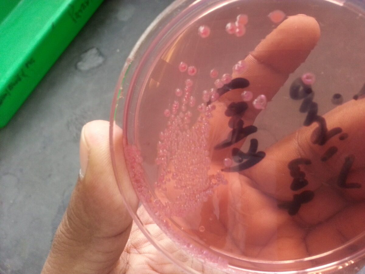 Louisiana’s Flesh-Eating Bacteria Outbreak: 5 Deaths, 55% Mortality Rate in 2026