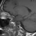 Cross-sectional MRI scan display showing the anatomical structure of the human cerebral cortex