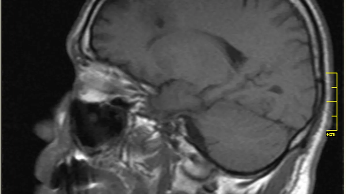 Cross-sectional MRI scan display showing the anatomical structure of the human cerebral cortex
