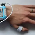 A wrist-worn smart monitoring device on a person’s arm with a small digital display.