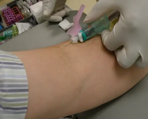 Photograph of a medical practitioner in sterile gloves drawing a venous blood sample into a vacutainer collection vial
