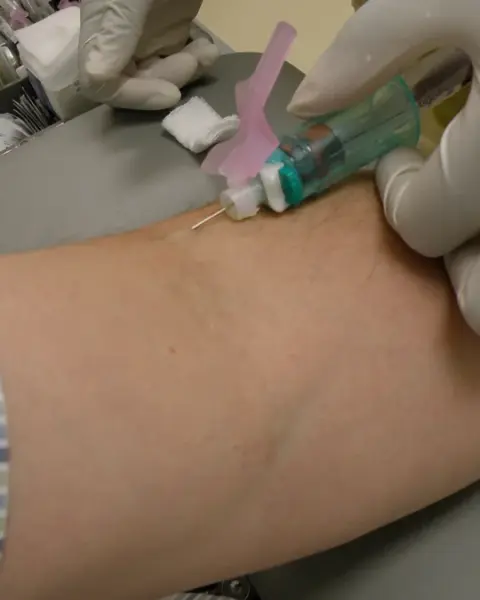 Photograph of a medical practitioner in sterile gloves drawing a venous blood sample into a vacutainer collection vial