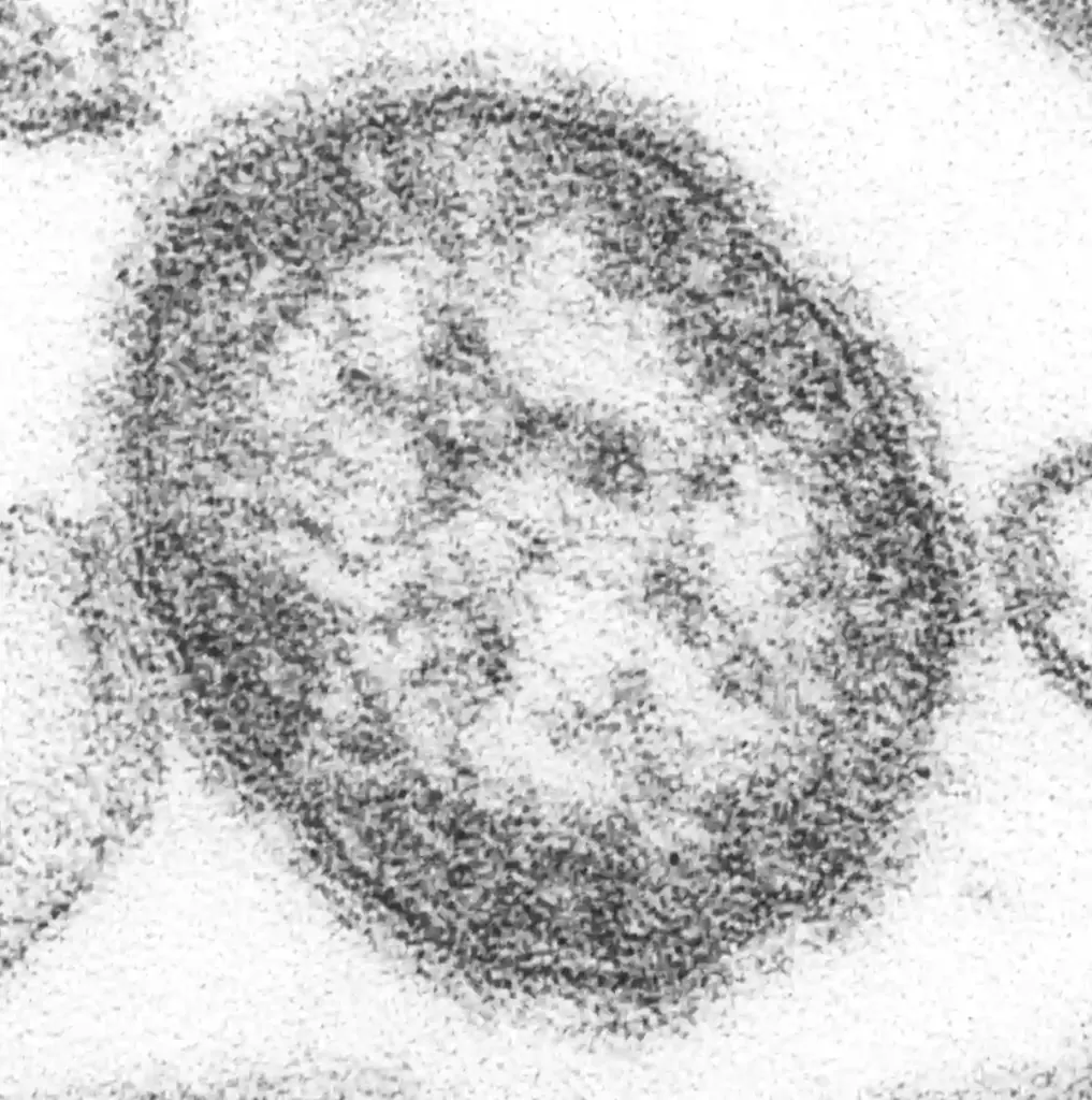 Microscopic view of the measles virus.