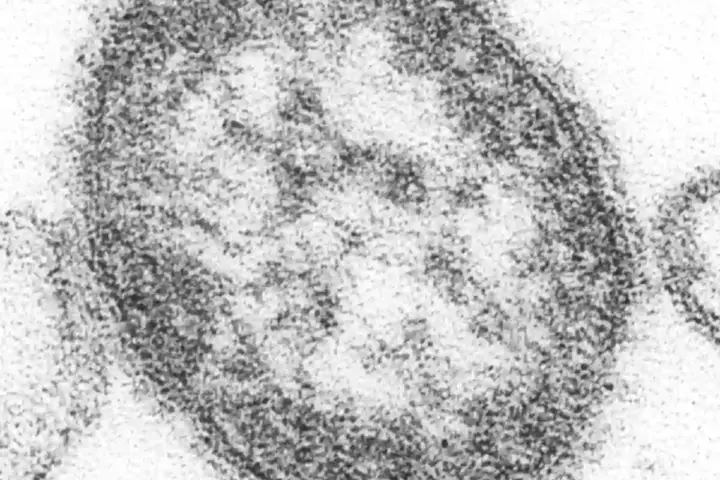 Microscopic view of the measles virus.
