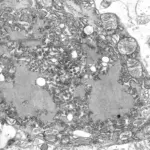 Black and white electron microscope image of rod-shaped rabies virus particles
