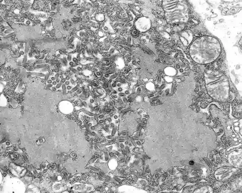 Black and white electron microscope image of rod-shaped rabies virus particles