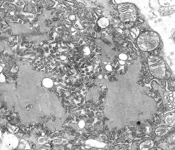 Black and white electron microscope image of rod-shaped rabies virus particles