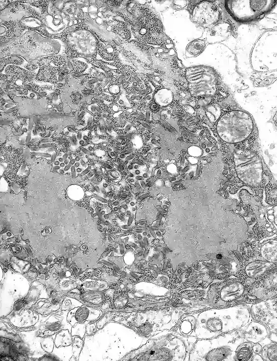 Black and white electron microscope image of rod-shaped rabies virus particles