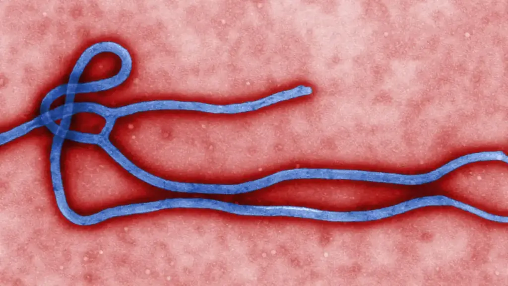 Colorized transmission electron micrograph showing the filamentous structure of an Ebola virus particle.