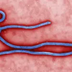 Colorized transmission electron micrograph showing the filamentous structure of an Ebola virus particle.