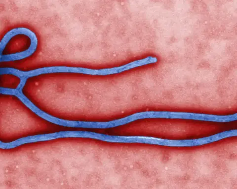 Colorized transmission electron micrograph showing the filamentous structure of an Ebola virus particle.