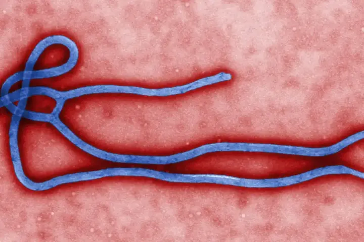 Colorized transmission electron micrograph showing the filamentous structure of an Ebola virus particle.
