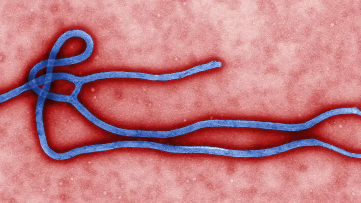Colorized transmission electron micrograph showing the filamentous structure of an Ebola virus particle.